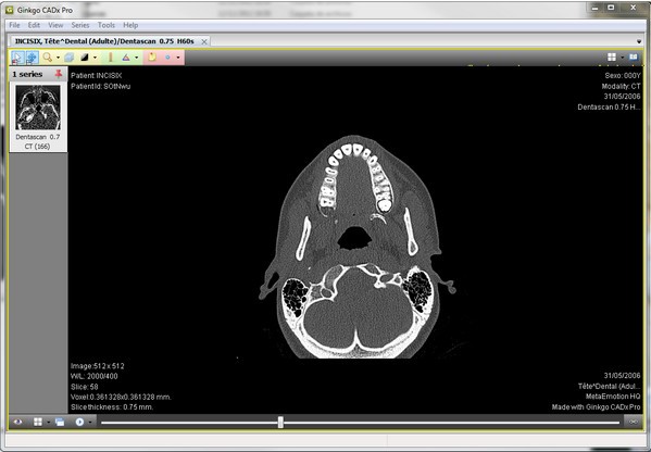 醫(yī)學(xué)影像瀏覽軟件下載