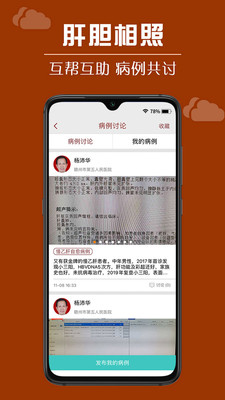 肝膽相照專家版